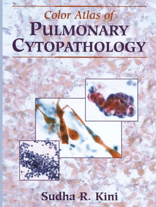 Cover of the book Color Atlas of Pulmonary Cytopathology by Sudha R. Kini, Pathology Images Inc., S.P. Hammar, P. Greensheet, M.J. Purslow, Springer New York