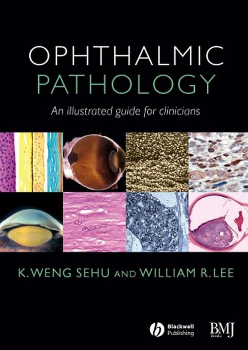 Cover of the book Ophthalmic Pathology by K. Weng Sehu, William R. Lee, Wiley
