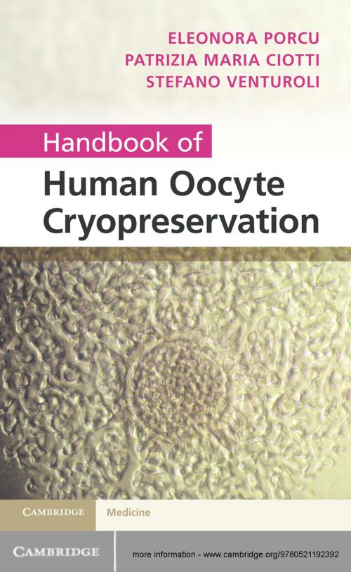 Cover of the book Handbook of Human Oocyte Cryopreservation by Eleonora Porcu, Patrizia Ciotti, Stefano Venturoli, Cambridge University Press