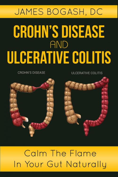 Cover of the book Crohn's Disease and Ulcerative Colitis: Calm the Flame in Your Gut Naturally by James Bogash, DC, James Bogash, DC