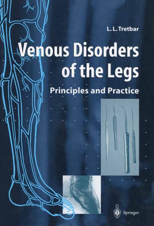 Cover of the book Venous Disorders of the Legs by Lawrence L. Tretbar, Springer London