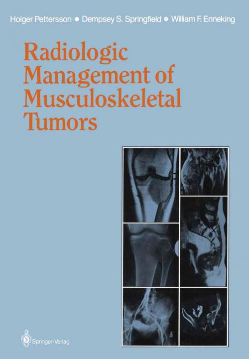 Cover of the book Radiologic Management of Musculoskeletal Tumors by William F. Enneking, Dempsey S. Springfield, Holger Pettersson, Springer London