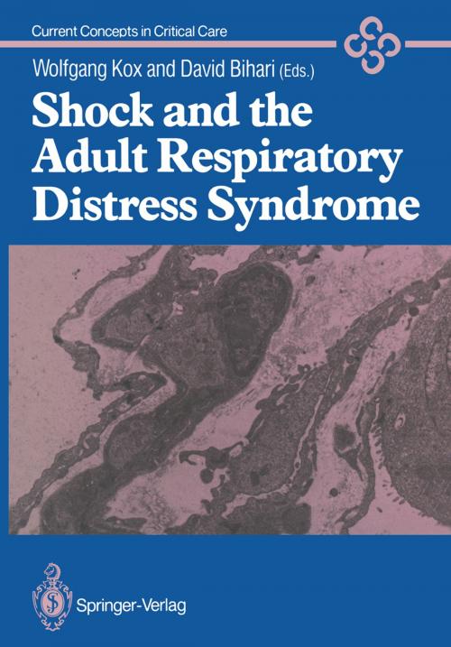 Cover of the book Shock and the Adult Respiratory Distress Syndrome by , Springer London