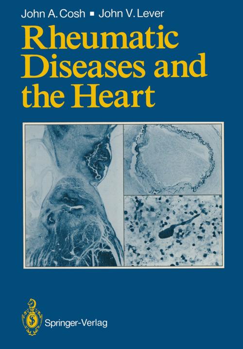 Cover of the book Rheumatic Diseases and the Heart by John A. Cosh, John V. Lever, Springer London