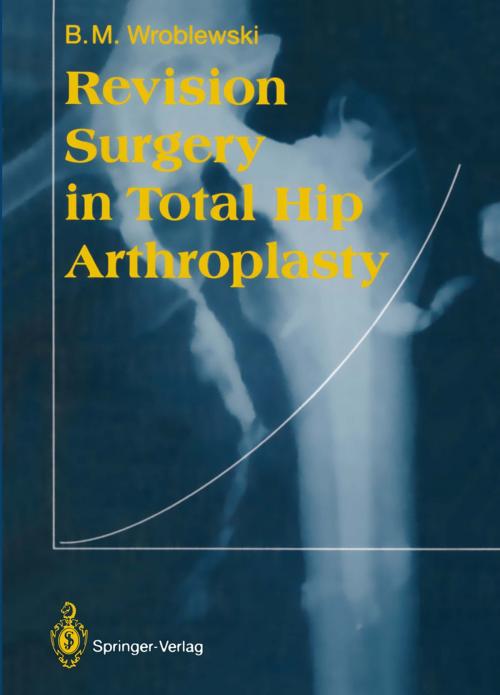 Cover of the book Revision Surgery in Total Hip Arthroplasty by Boguslaw M. Wroblewski, Springer London