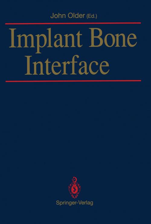 Cover of the book Implant Bone Interface by , Springer London