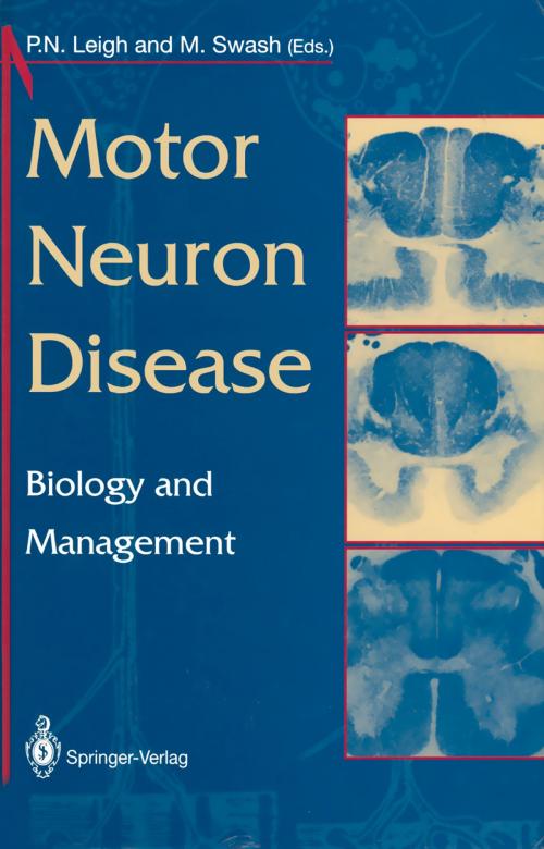 Cover of the book Motor Neuron Disease by , Springer London
