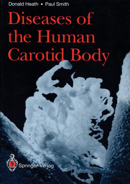 Cover of the book Diseases of the Human Carotid Body by Paul Smith, Donald Heath, Springer London