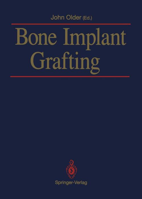 Cover of the book Bone Implant Grafting by , Springer London