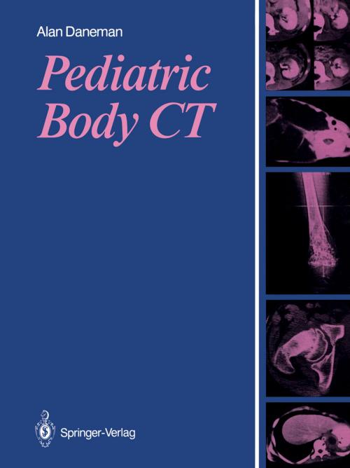 Cover of the book Pediatric Body CT by Alan Daneman, Springer London