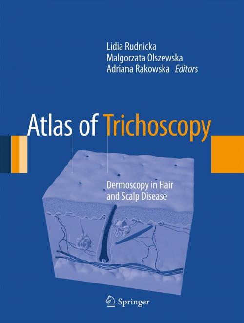Cover of the book Atlas of Trichoscopy by , Springer London