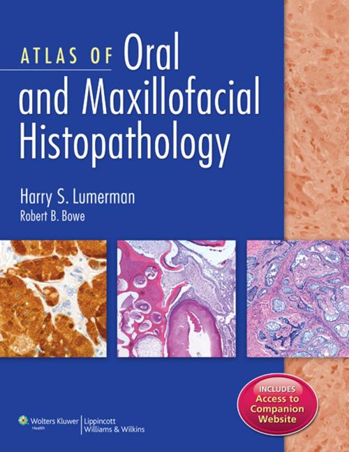 Cover of the book Atlas of Oral and Maxillofacial Histopathology by Harry S. Lumerman, Robert B. Bowe, Wolters Kluwer Health