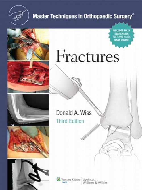 Cover of the book Master Techniques in Orthopaedic Surgery: Fractures by Donald Wiss, Wolters Kluwer Health