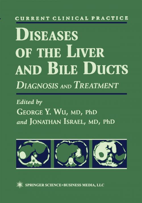 Cover of the book Diseases of the Liver and Bile Ducts by , Humana Press
