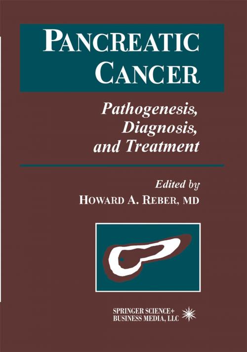 Cover of the book Pancreatic Cancer by , Humana Press