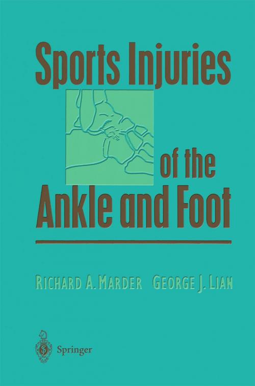 Cover of the book Sports Injuries of the Ankle and Foot by Richard A. Marder, George J. Lian, Springer New York