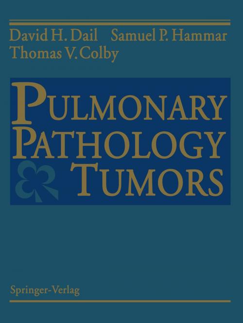 Cover of the book Pulmonary Pathology — Tumors by David H. Dail, Samuel P. Hammar, Thomas V. Colby, Springer New York