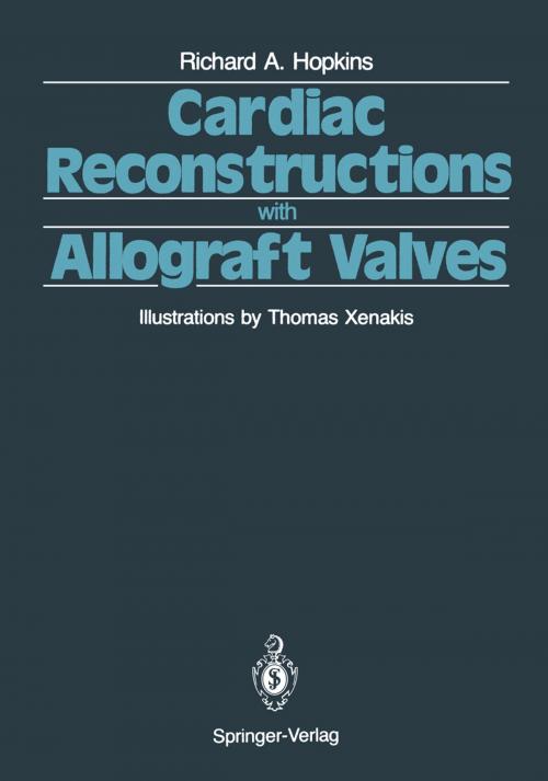 Cover of the book Cardiac Reconstructions with Allograft Valves by V.J. Ferrans, Richard A. Hopkins, S.L. Hilbert, P.L. Lange, L. Jr. Wolfinbarger, M. Jones, Springer New York