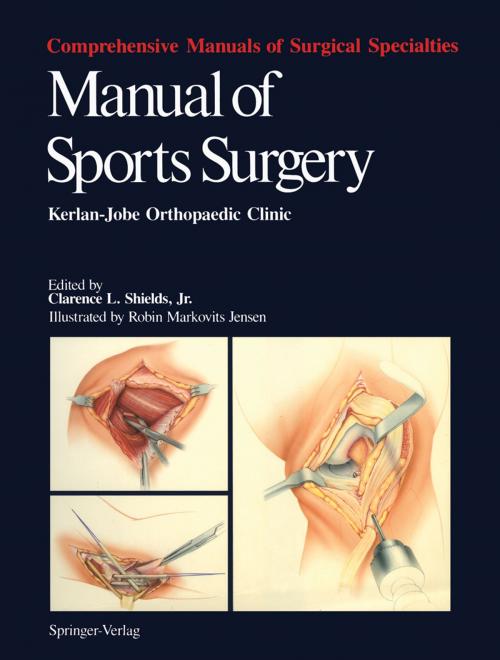 Cover of the book Manual of Sports Surgery by C.E. Brewster, M.C. Morrissey, J.L. Seto, S.J. Lombardo, H.R. Collins, L.A. Yocum, V.S. Carter, J.E. Tibone, R.K. Kerlan, C.L.Jr. Shields, Springer New York