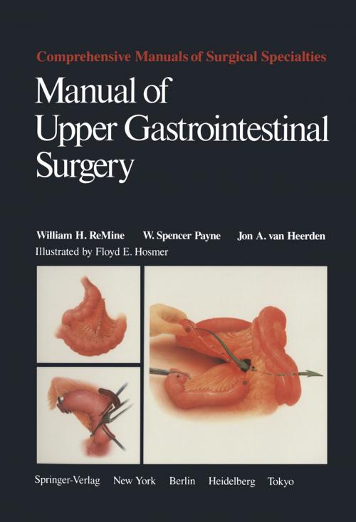 Cover of the book Manual of Upper Gastrointestinal Surgery by William H. ReMine, W. Spencer Payne, Jon A. van Heerden, Springer New York