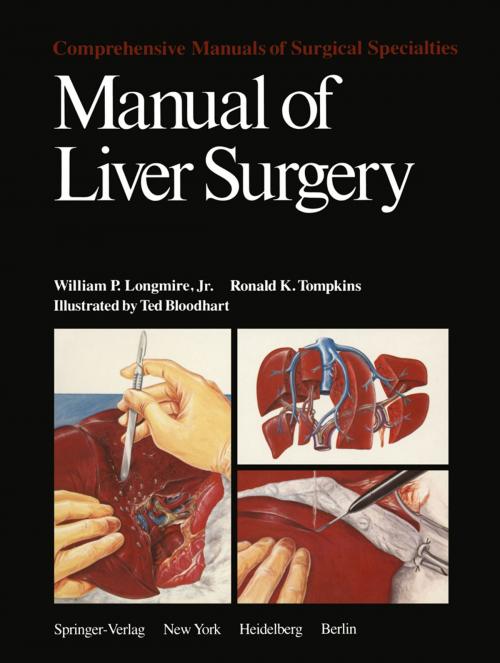 Cover of the book Manual of Liver Surgery by W.P. Longmire, R.K. Tompkins, Springer New York