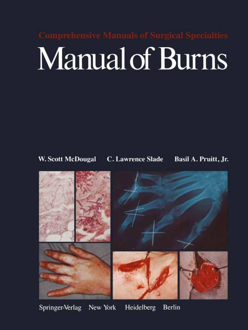 Cover of the book Manual of Burns by W.S. McDougal, C.L. Slade, B.A.Jr. Pruitt, Springer New York