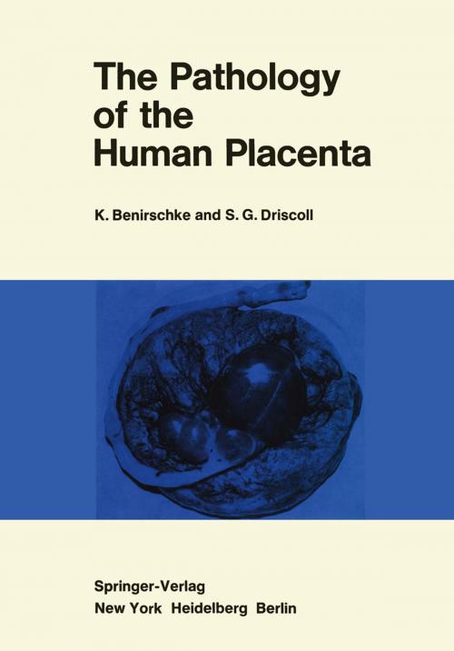 Cover of the book The Pathology of the Human Placenta by KURT BENIRSCHKE, Springer New York