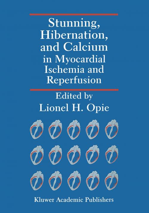 Cover of the book Stunning, Hibernation, and Calcium in Myocardial Ischemia and Reperfusion by , Springer US