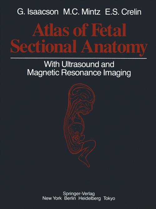Cover of the book Atlas of Fetal Sectional Anatomy by Glenn Isaacson, Marshall C. Mintz, Edmund S. Crelin, Springer New York