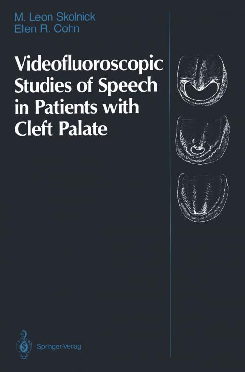 Cover of the book Videofluoroscopic Studies of Speech in Patients with Cleft Palate by M. Leon Skolnick, Ellen R. Cohn, Springer New York