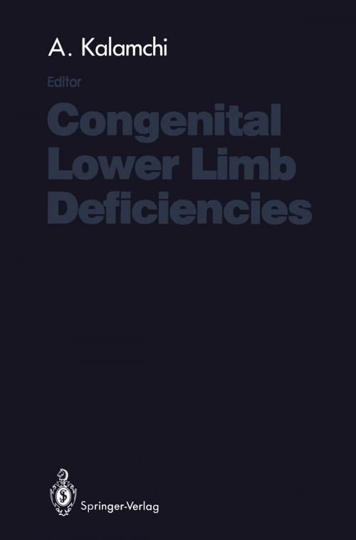 Cover of the book Congenital Lower Limb Deficiencies by , Springer New York