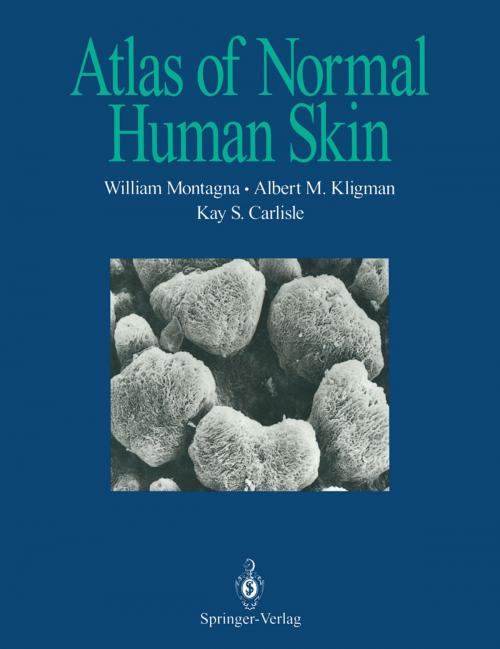 Cover of the book Atlas of Normal Human Skin by Albert M. Kligman, Kay S. Carlisle, William Montagna, Springer New York