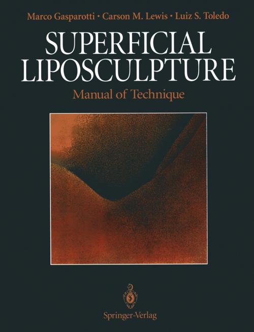 Cover of the book Superficial Liposculpture by Marco Gasparotti, Carson M. Lewis, Luiz S. Toledo, Springer New York
