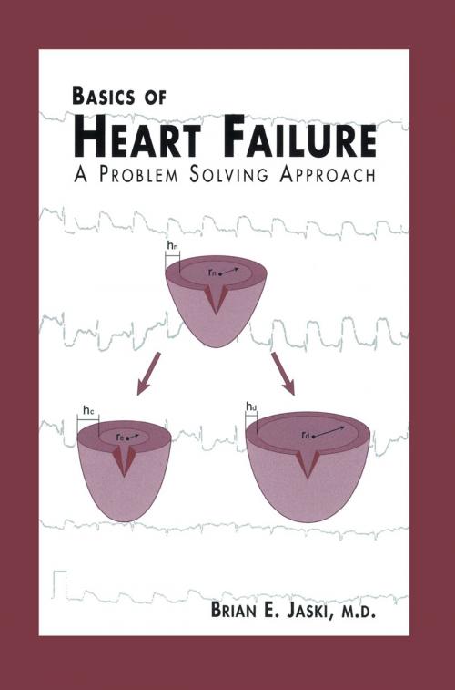 Cover of the book Basics of Heart Failure by Brian E. Jaski, Springer US
