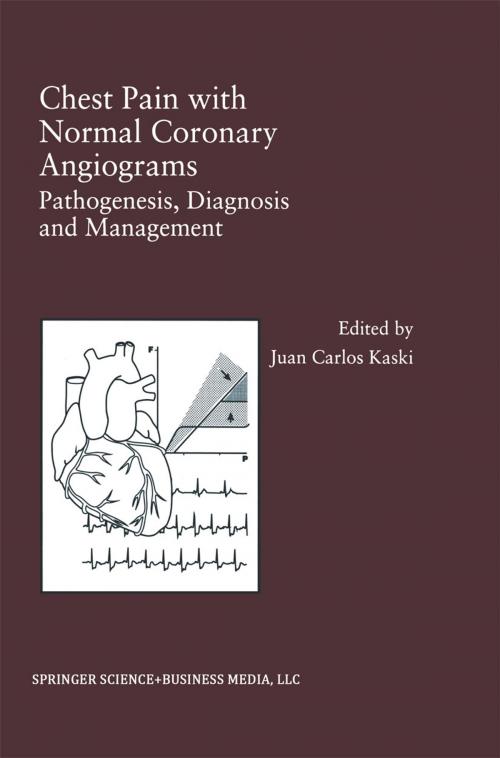 Cover of the book Chest Pain with Normal Coronary Angiograms: Pathogenesis, Diagnosis and Management by , Springer US