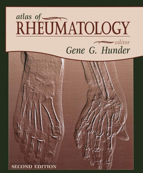 Cover of the book Atlas of Rheumatology by Gene Hunder, Current Medicine Group
