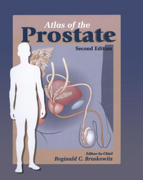 Cover of the book Atlas of the Prostate by , Current Medicine Group