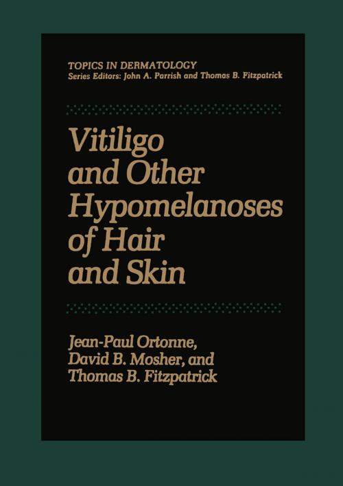 Cover of the book Vitiligo and Other Hypomelanoses of Hair and Skin by Jean-Paul Ortonne, Springer US