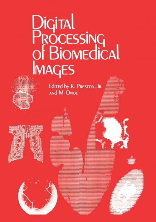 Cover of the book Digital Processing of Biomedical Images by , Springer US