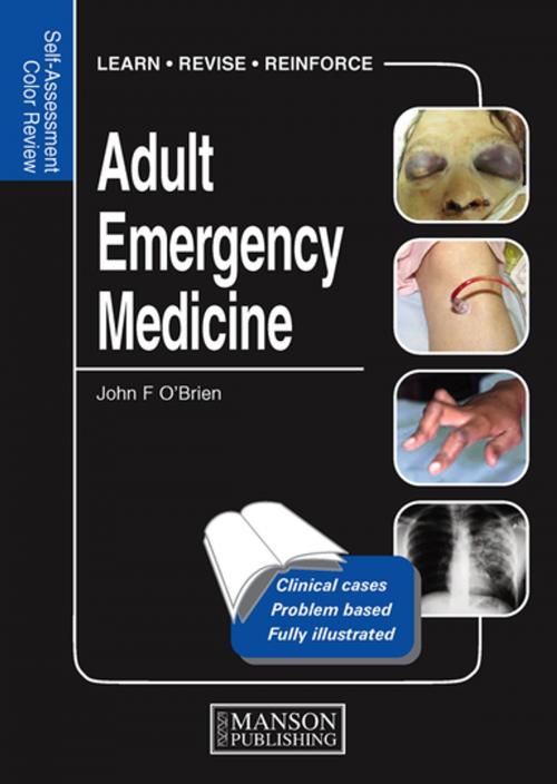 Cover of the book Adult Emergency Medicine by John O'Brien, CRC Press