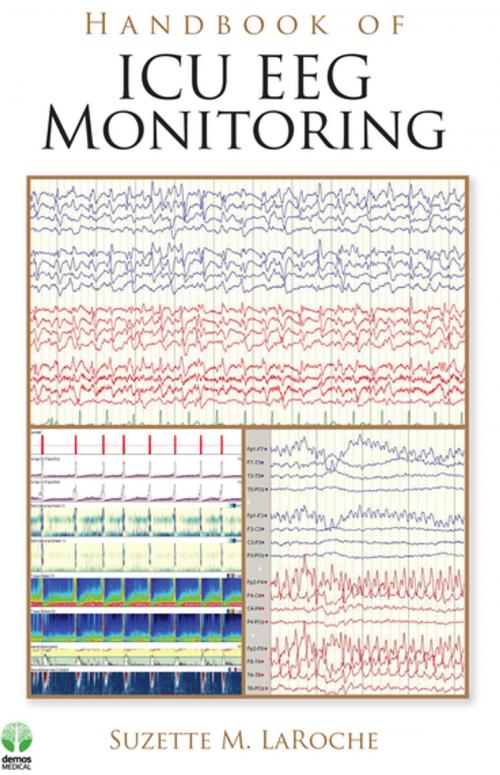 Cover of the book Handbook of ICU EEG Monitoring by , Springer Publishing Company