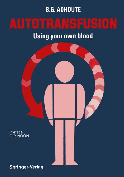 Cover of the book Autotransfusion by K. MESSMER, Springer Paris