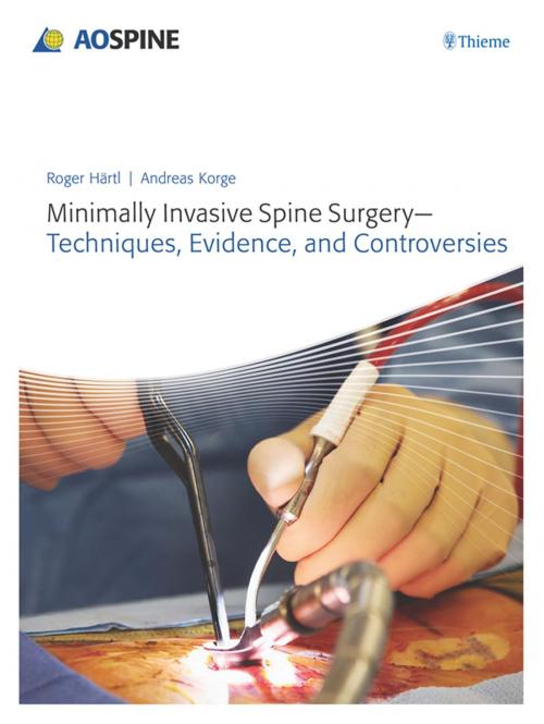 Cover of the book Minimally Invasive Spine Surgery by Roger Haertl, Andreas Korge, Thieme/AO