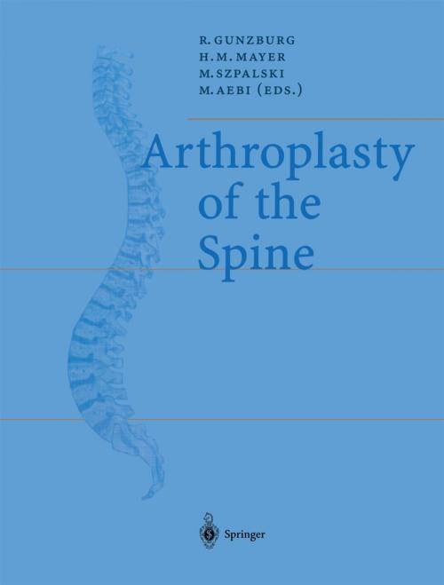 Cover of the book Arthroplasty of the Spine by , Springer Berlin Heidelberg
