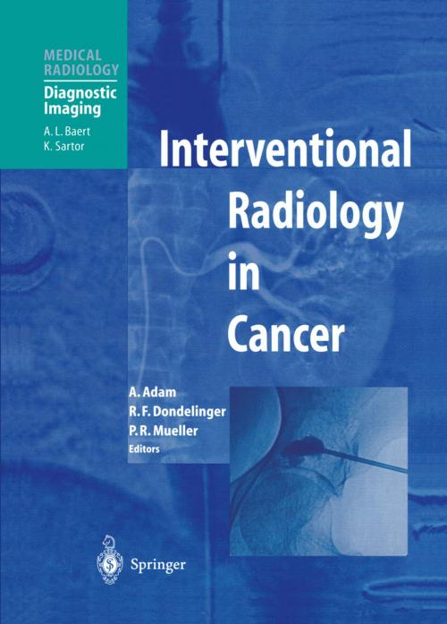 Cover of the book Interventional Radiology in Cancer by , Springer Berlin Heidelberg