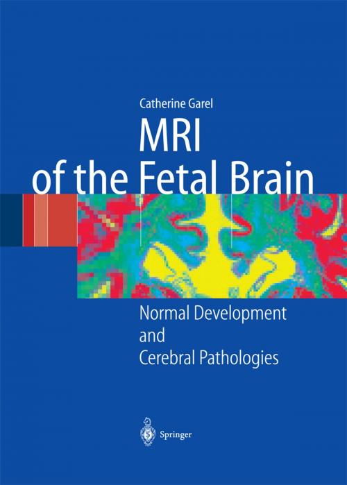 Cover of the book MRI of the Fetal Brain by C. Garel, A.-L. Delezoide, L. Guibaud, G. Sebag, P. Gressens, M. Elmaleh-Bergès, M. Hassan, H. Brisse, E. Chantrel, Springer Berlin Heidelberg