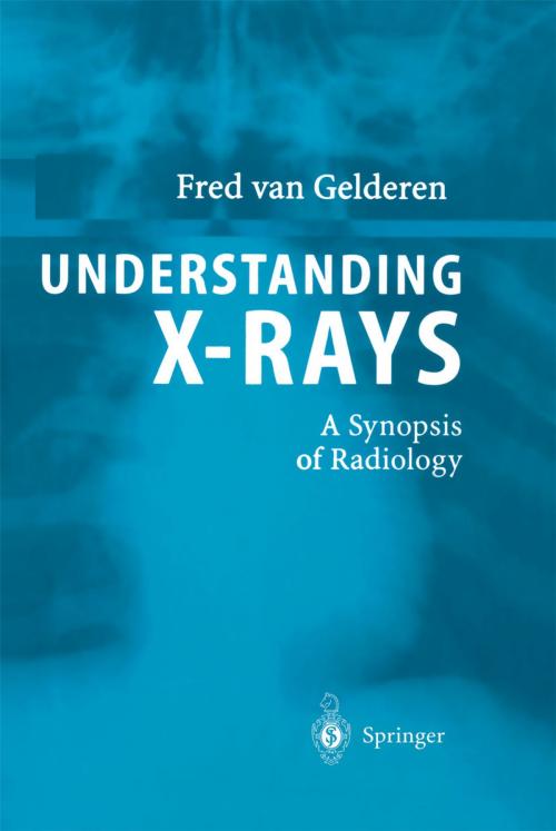 Cover of the book Understanding X-Rays by Fred van Gelderen, Springer Berlin Heidelberg