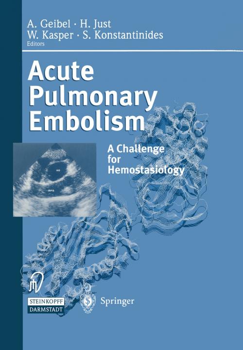 Cover of the book Acute Pulmonary Embolism by , Steinkopff