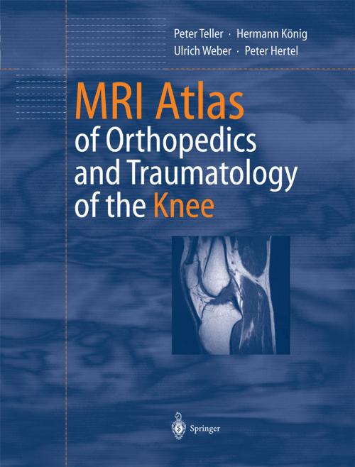 Cover of the book MRI Atlas of Orthopedics and Traumatology of the Knee by Peter Hertel, Peter Teller, Ulrich Weber, Hermann König, Springer Berlin Heidelberg