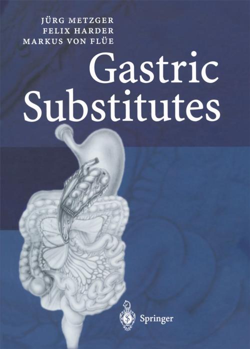 Cover of the book Gastric Substitutes by Jürg Metzger, Felix Harder, Markus von Flüe, Springer Berlin Heidelberg